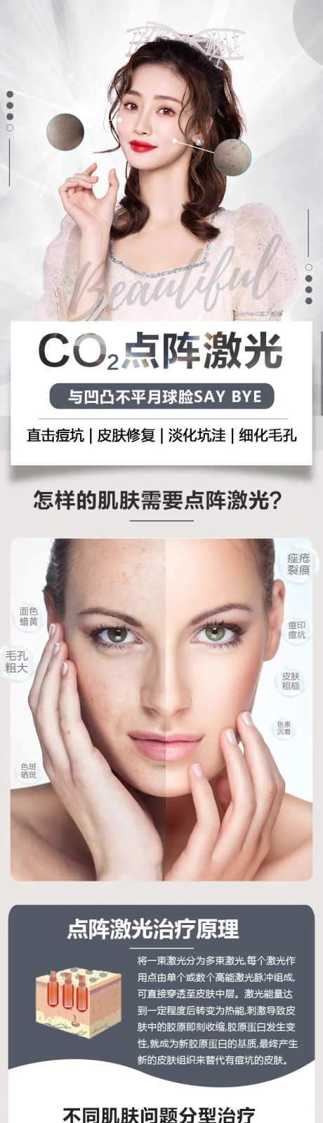 点阵激光-采灵感-https://www.cailinggan.com/