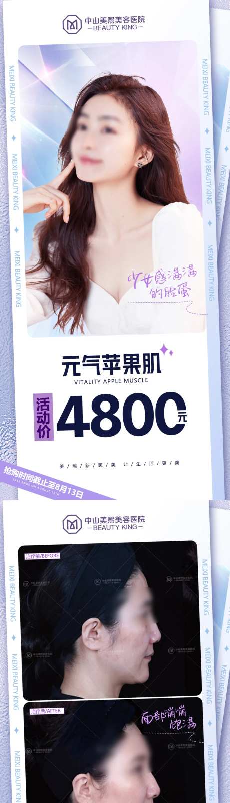 苹果肌价格海报-采灵感-https://www.cailinggan.com/