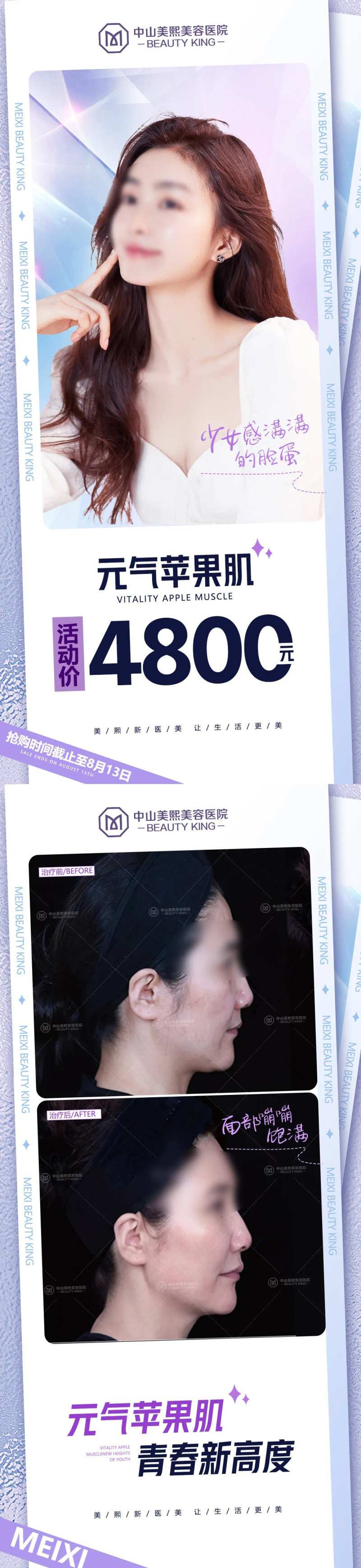 苹果肌价格海报-采灵感-cailinggan.com