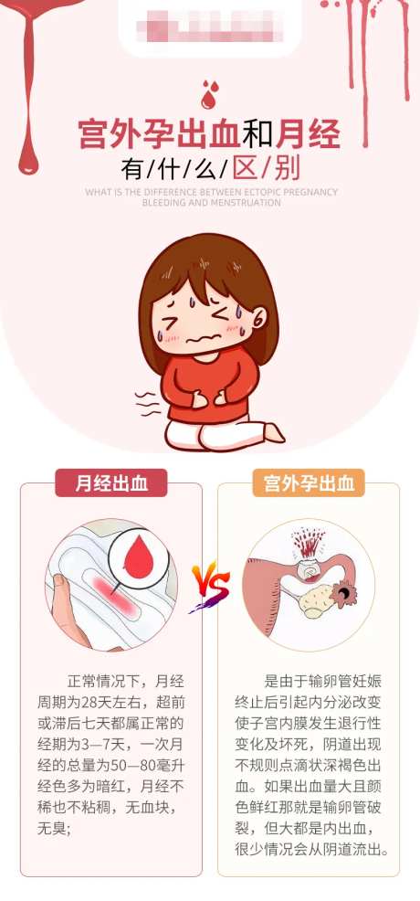 宫外孕出血和月经区别海报-采灵感-https://www.cailinggan.com/