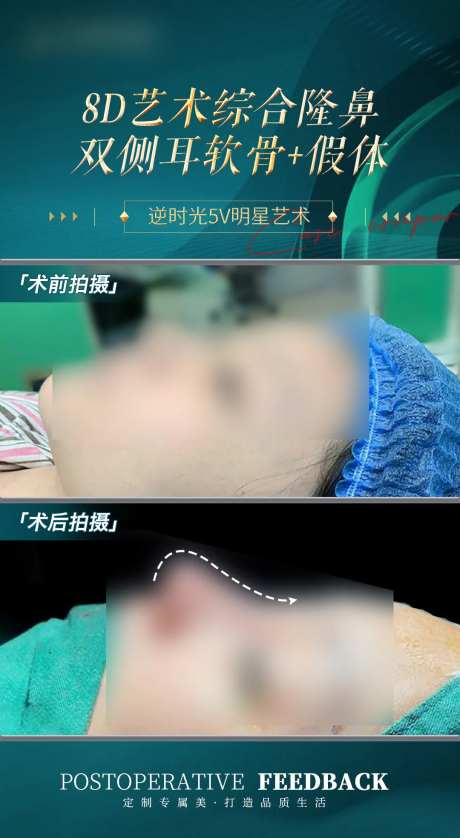 医美鼻子整形案例宣传海报-采灵感-https://www.cailinggan.com/