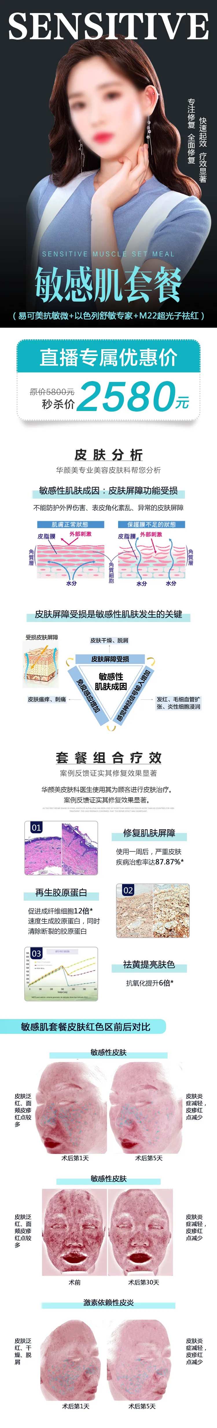 敏感肌套餐易可美抗敏详情-采灵感-cailinggan.com