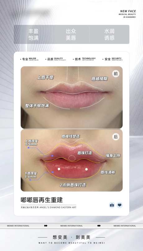 嘟嘟唇再生重建-采灵感-https://www.cailinggan.com/