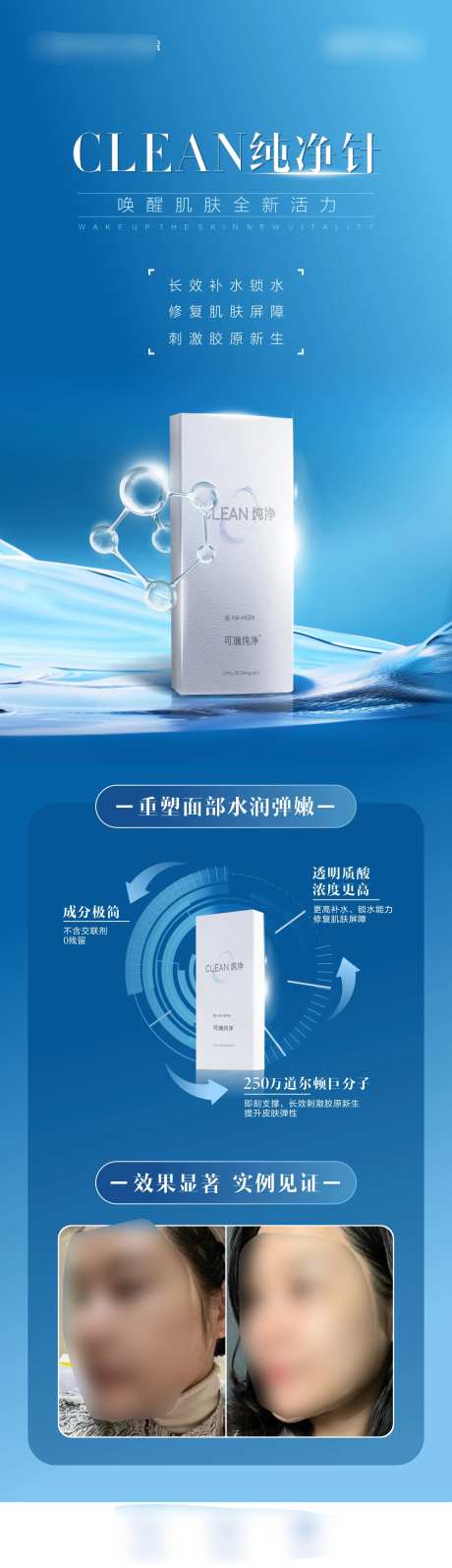 医美产品案例宣传海波-采灵感-https://www.cailinggan.com/