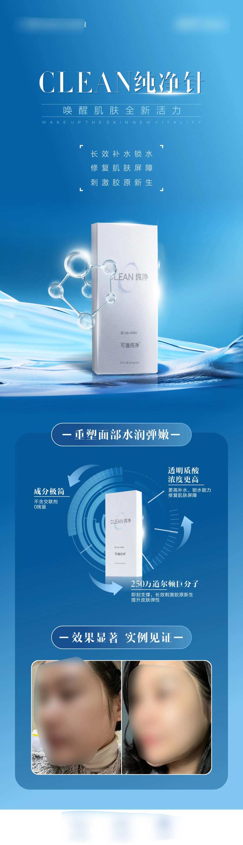 医美产品案例宣传海波-采灵感-cailinggan.com