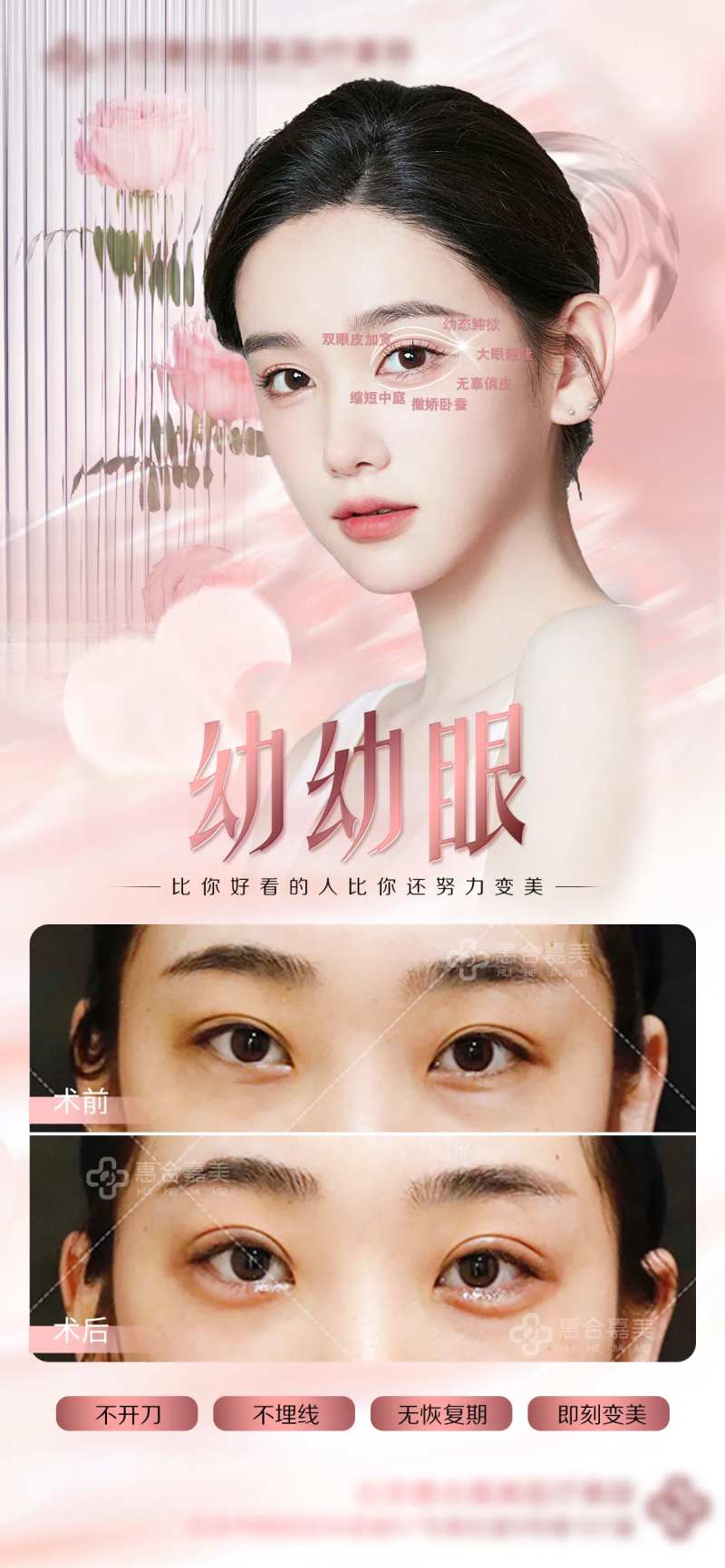 幼幼眼整形海报-采灵感-cailinggan.com