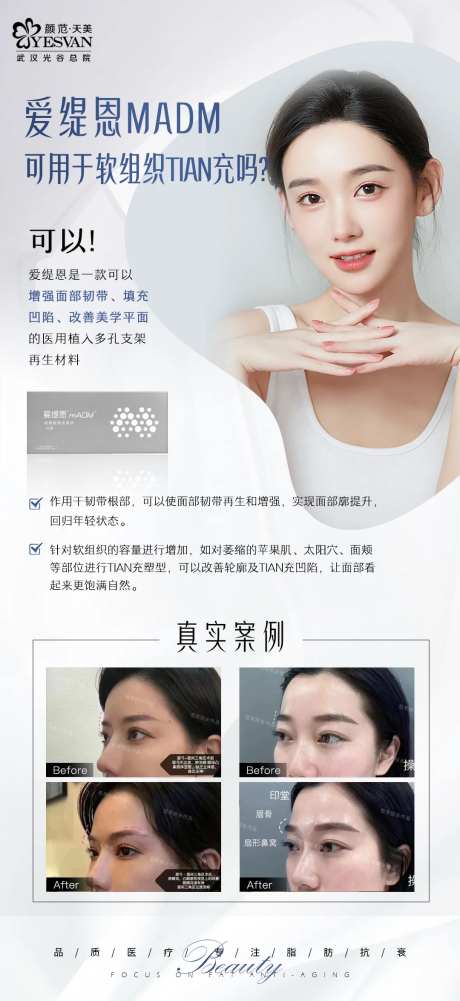 爱缇恩项目宣传海报-采灵感-https://www.cailinggan.com/