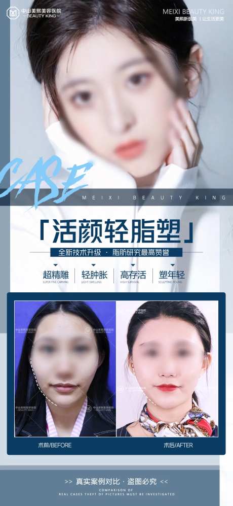 医美脸部填充案例海报-采灵感-https://www.cailinggan.com/