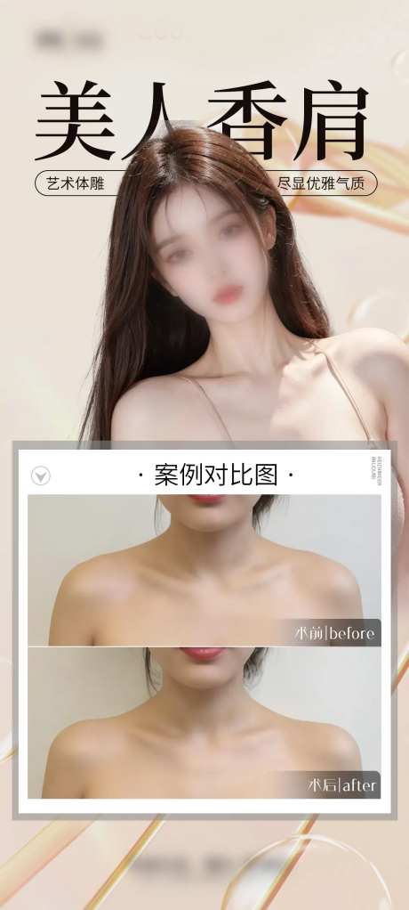 医美美人肩案例海报-采灵感-https://www.cailinggan.com/