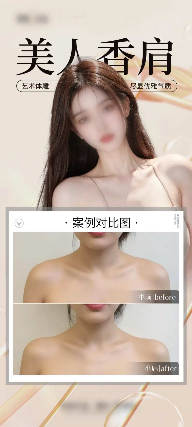 医美美人肩案例海报-采灵感-cailinggan.com