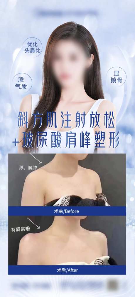 瘦肩-采灵感-https://www.cailinggan.com/