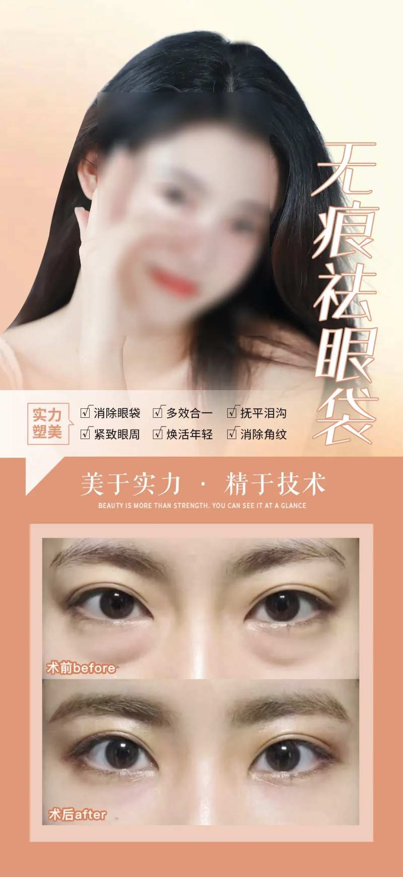 无痕祛眼袋整形案例-采灵感-cailinggan.com
