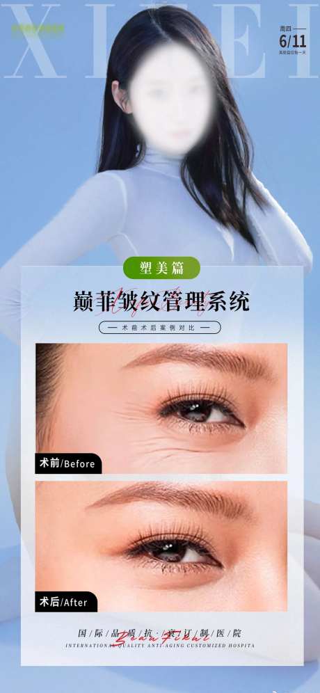 医美案例对比图-采灵感-https://www.cailinggan.com/