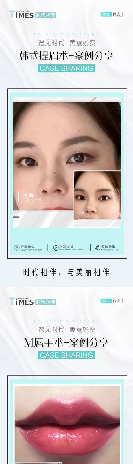 医美项目前后对比案例分享系列海报-采灵感-https://www.cailinggan.com/