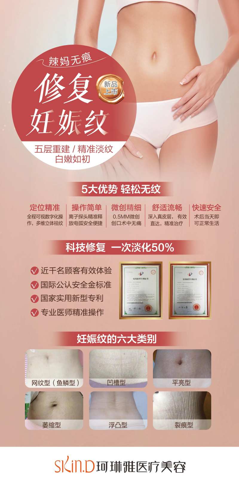 妊娠纹修复医美展架-采灵感-cailinggan.com