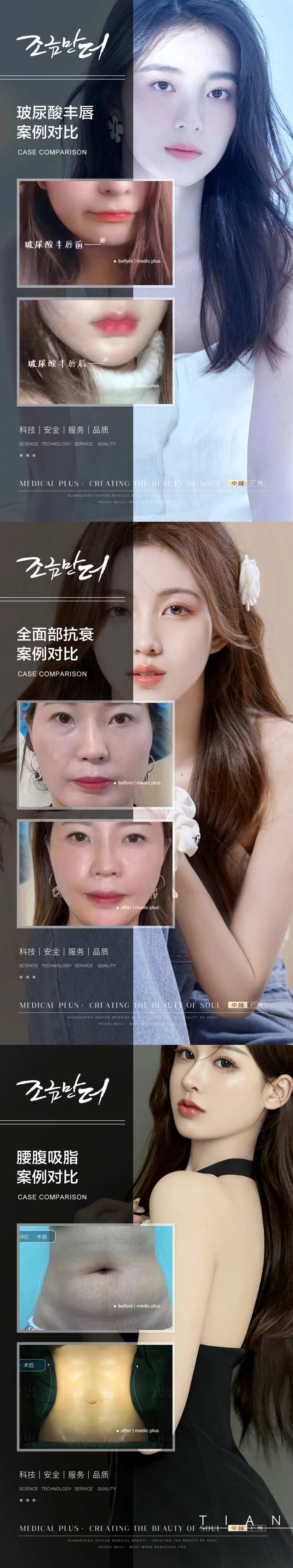 整形真人案例分享集-采灵感-cailinggan.com