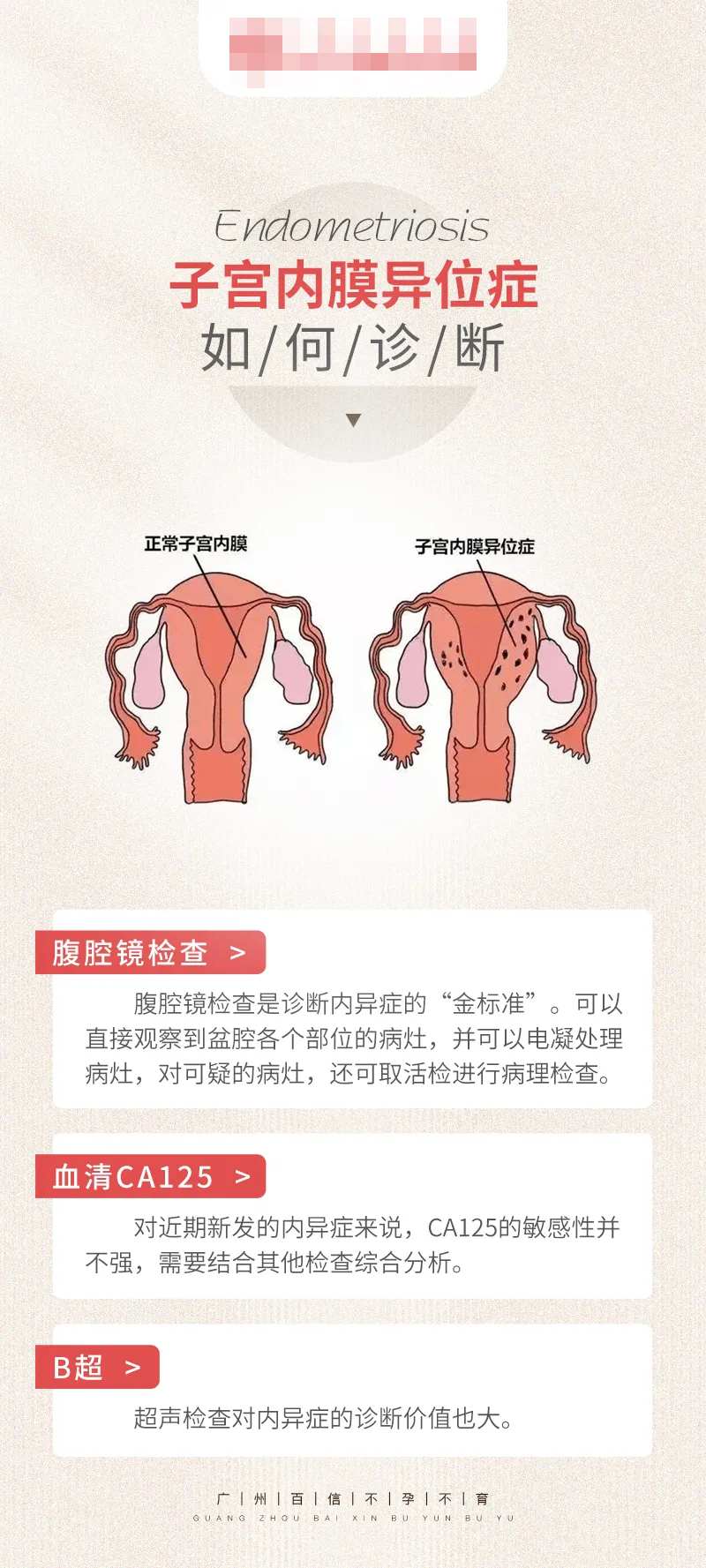 子宫内膜异位科普海报-采灵感-cailinggan.com