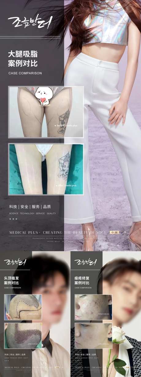 医美植发案例对比-采灵感-https://www.cailinggan.com/