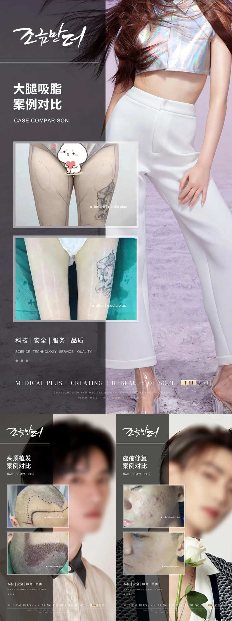 医美植发案例对比-采灵感-cailinggan.com