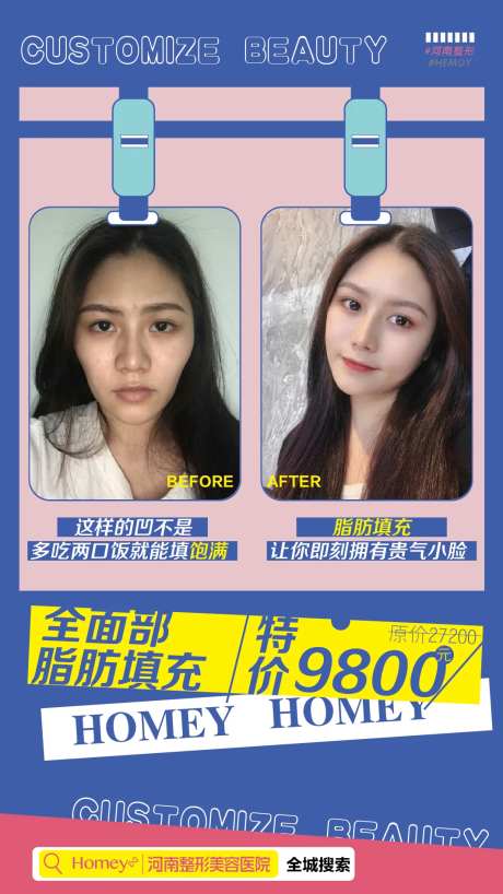 医美脂肪填充案例海报-采灵感-https://www.cailinggan.com/