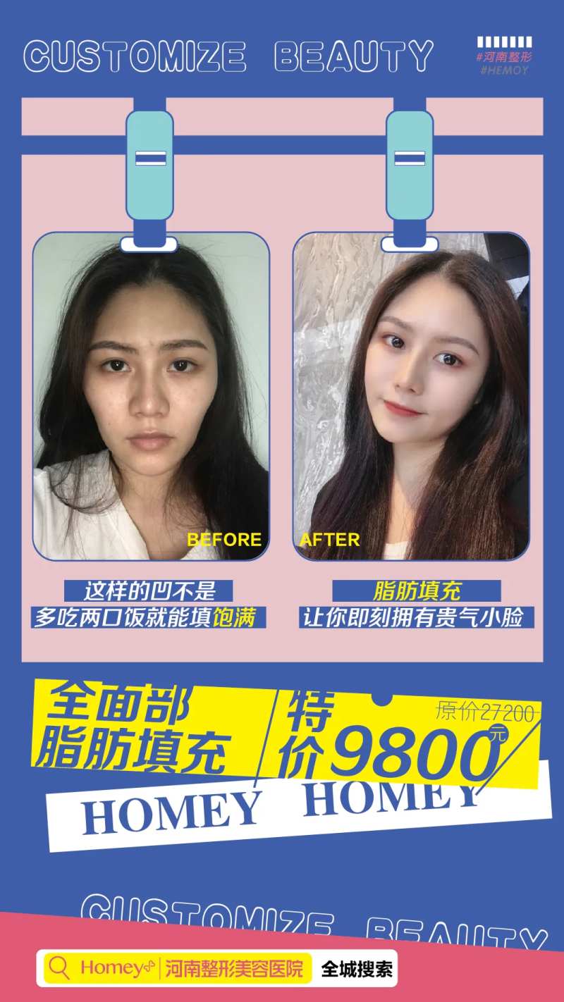 医美脂肪填充案例海报-采灵感-cailinggan.com