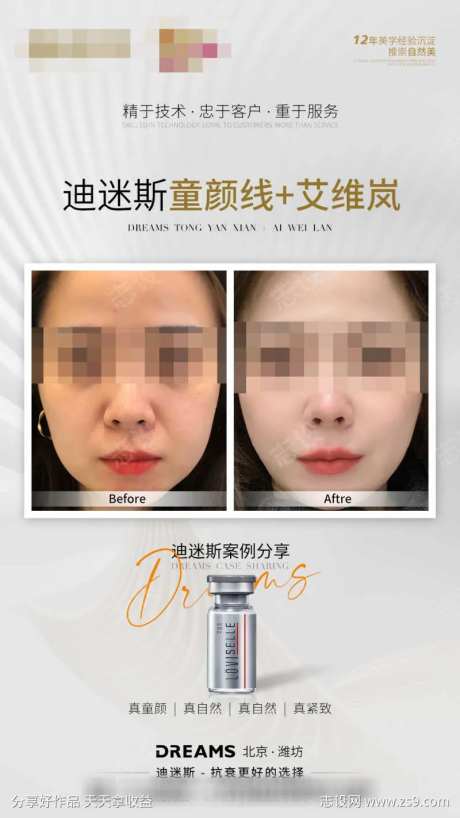 医美艾维岚线雕案例图-采灵感-https://www.cailinggan.com/