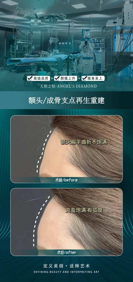 医美额头整形案例-采灵感-https://www.cailinggan.com/