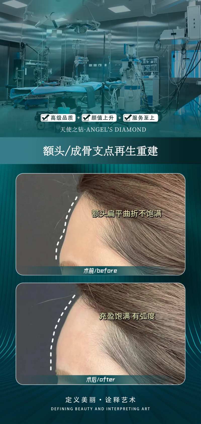 医美额头整形案例-采灵感-cailinggan.com