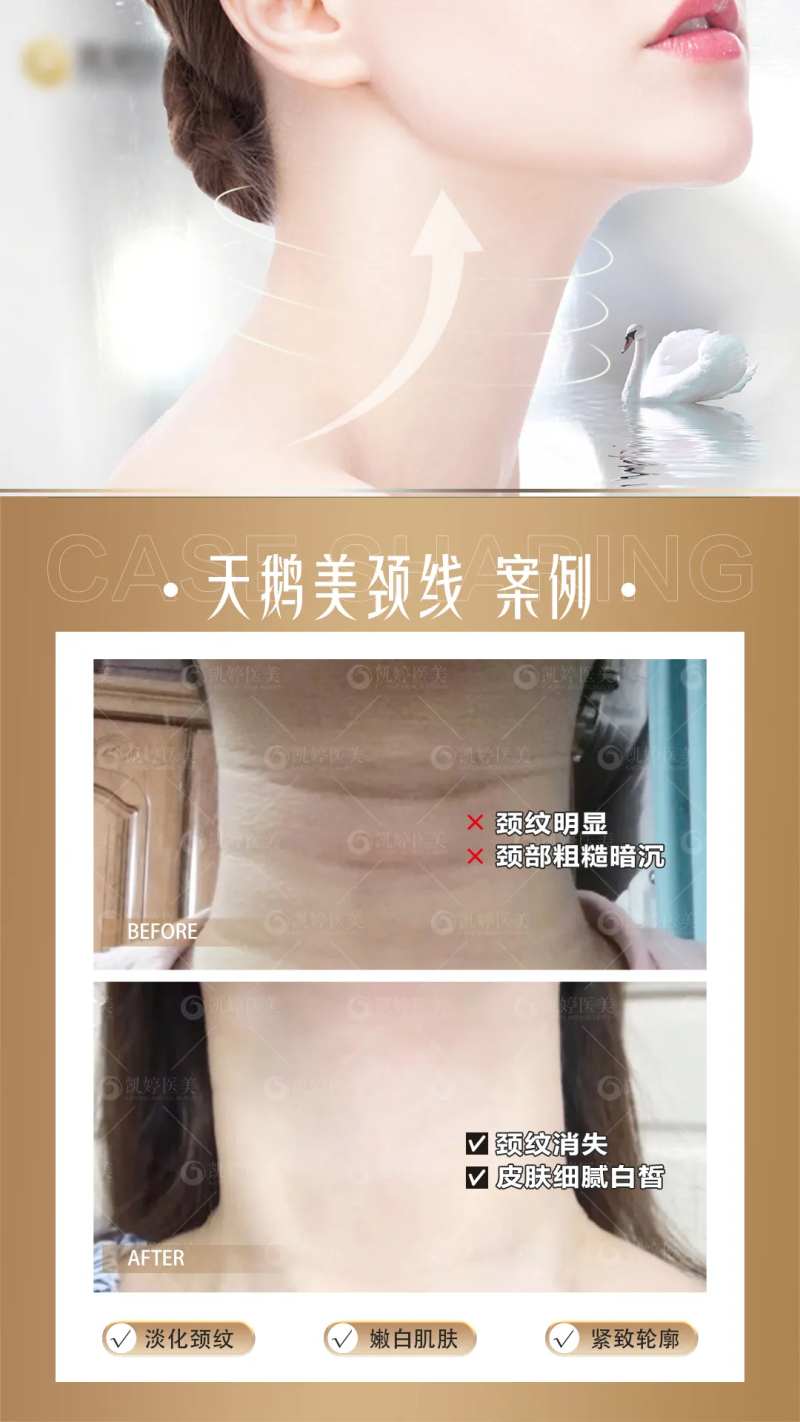 医美颈部对比图-采灵感-cailinggan.com
