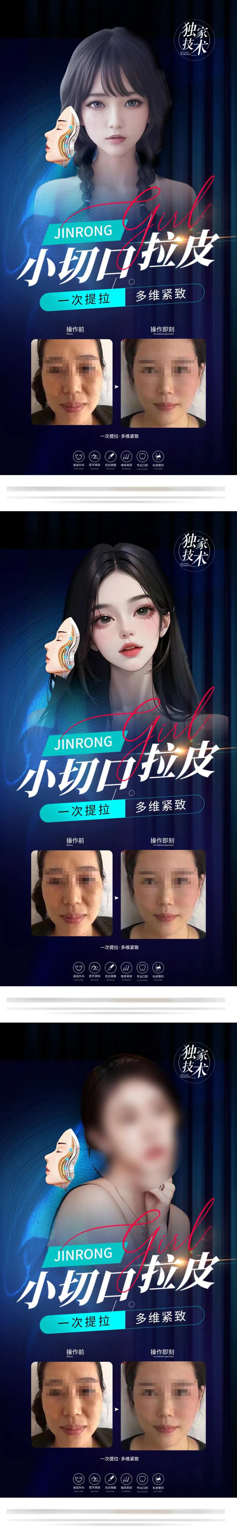 医美小切口拉皮海报-采灵感-cailinggan.com