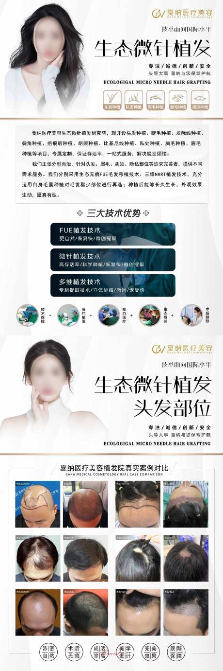 生态微针植发KT版海报-采灵感-https://www.cailinggan.com/