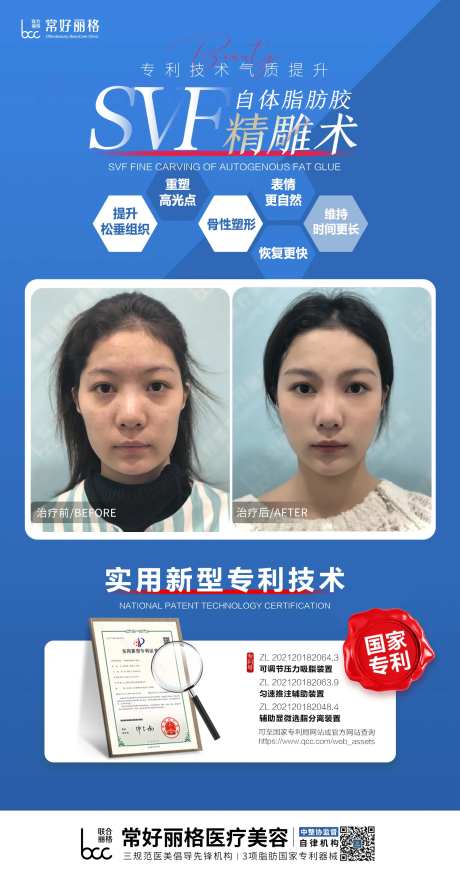 医美脂肪填充案例对比海报-采灵感-https://www.cailinggan.com/