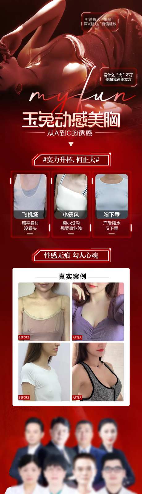 医美整形隆胸隆胸丰胸美女案例对比-采灵感-https://www.cailinggan.com/