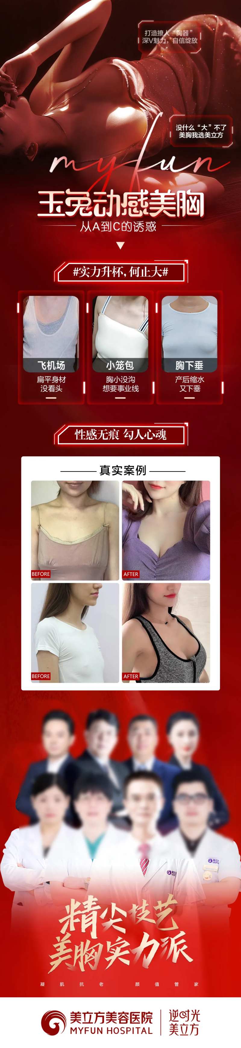 医美整形隆胸隆胸丰胸美女案例对比-采灵感-cailinggan.com