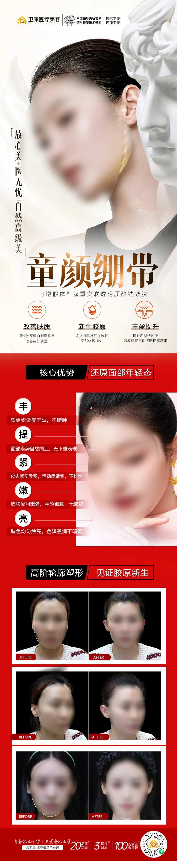 童颜绷带注射医美-采灵感-cailinggan.com