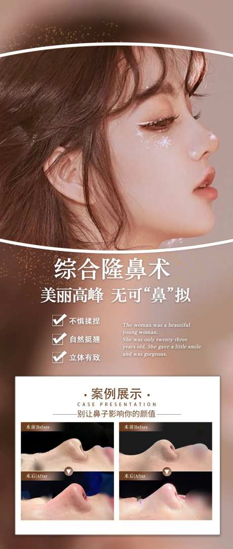 隆鼻真人案例医美整形项目-采灵感-https://www.cailinggan.com/