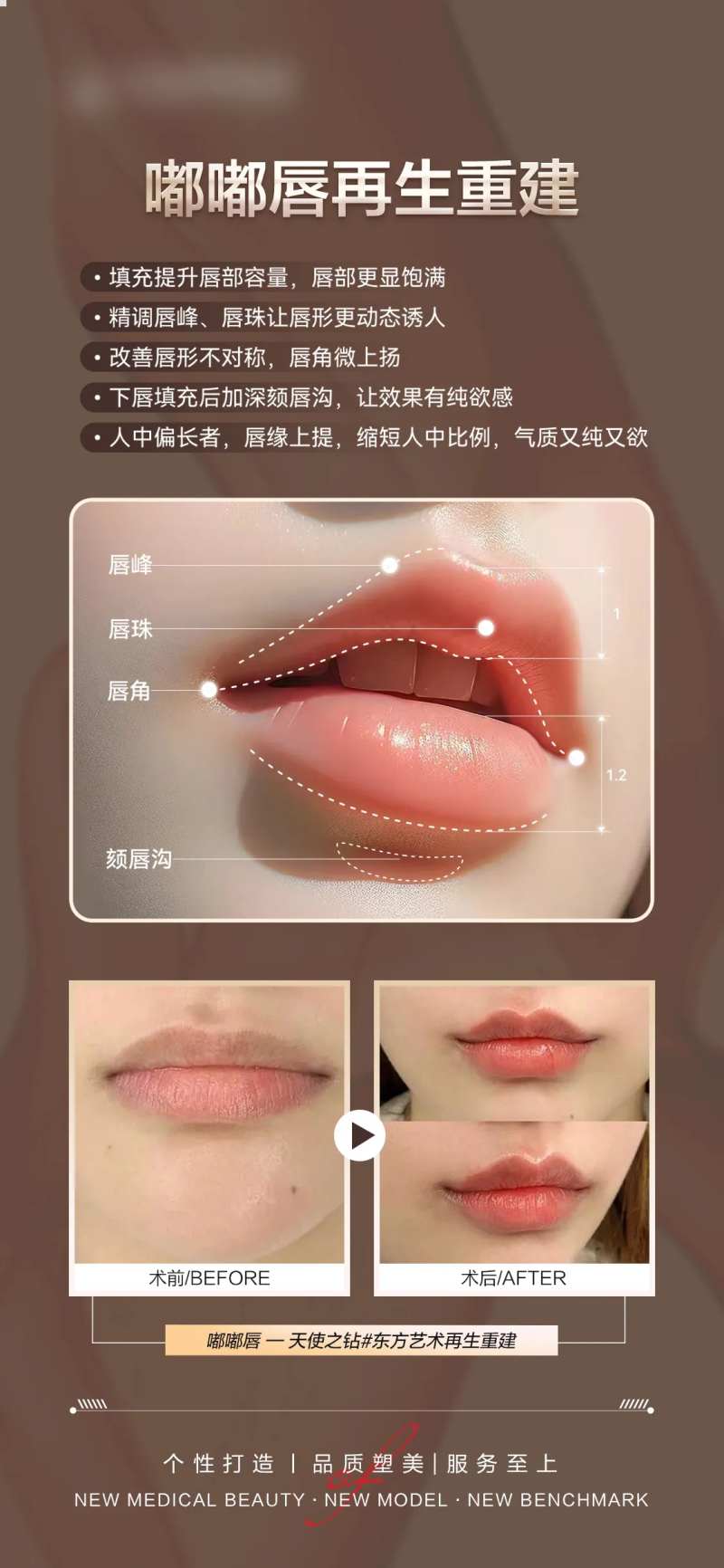 医美嘟嘟唇案例对比-采灵感-cailinggan.com