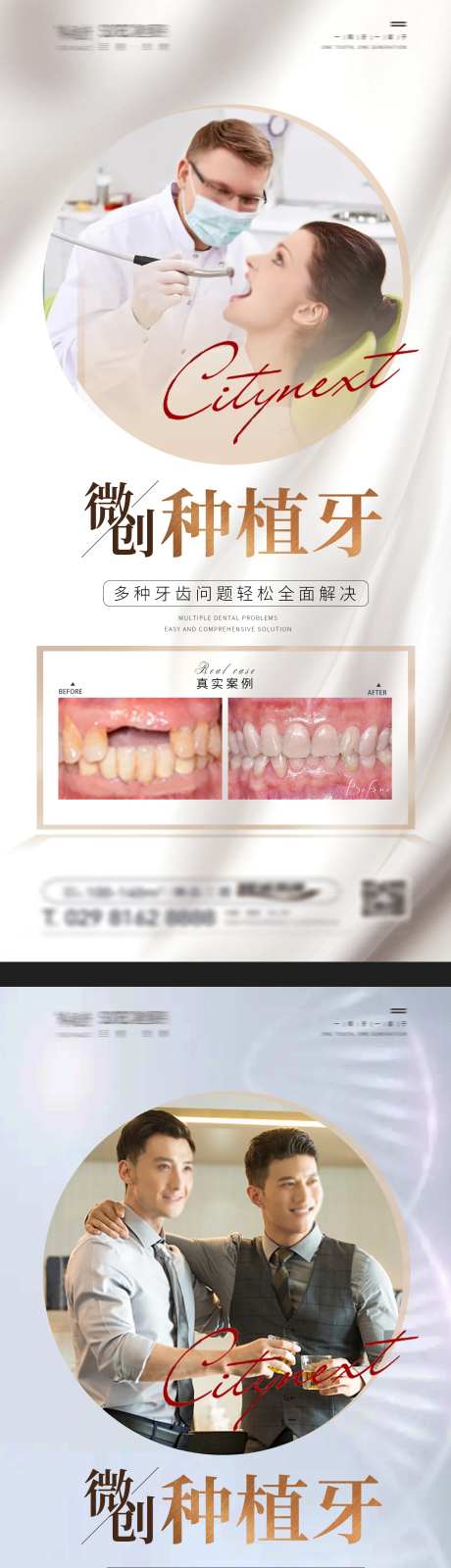 口口腔种植牙案例宣传海报-采灵感-https://www.cailinggan.com/