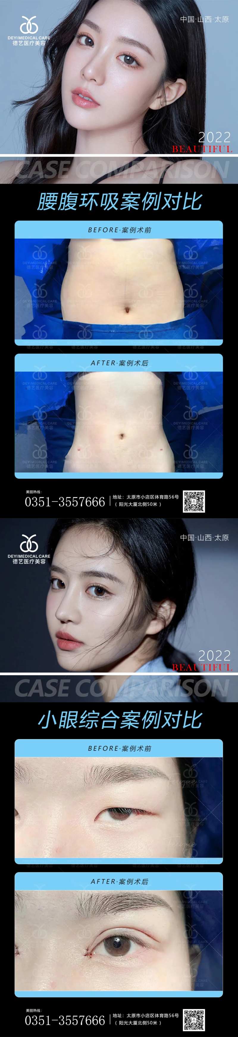 医美案例对比图-采灵感-cailinggan.com