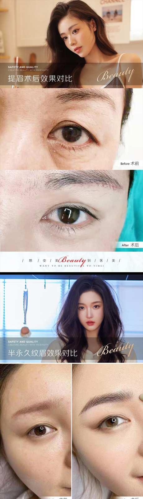 医美案例模板-采灵感-https://www.cailinggan.com/