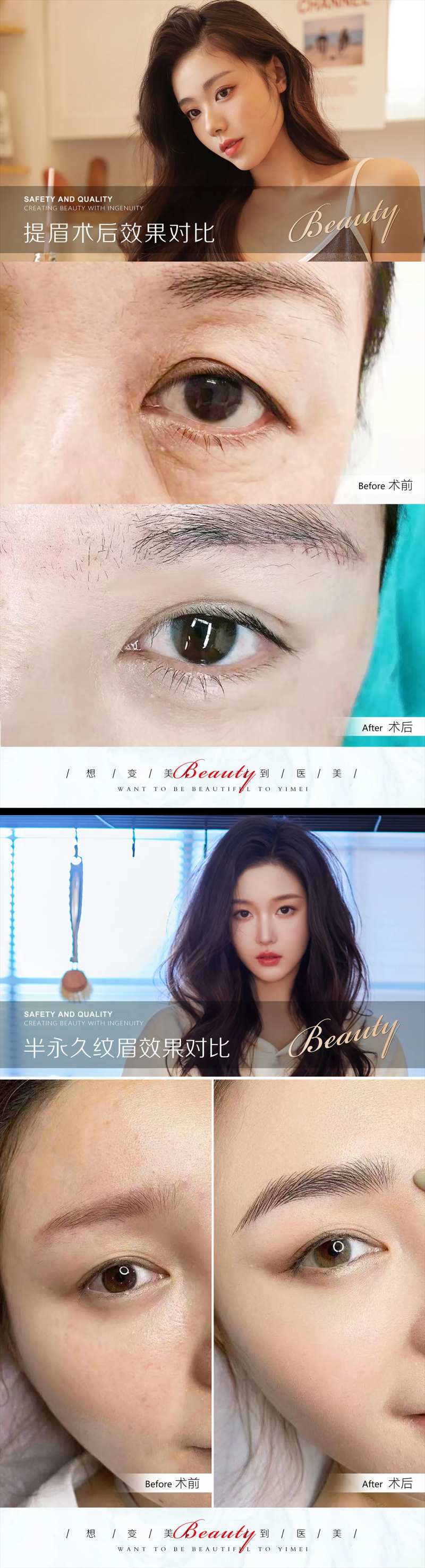 医美案例模板-采灵感-cailinggan.com