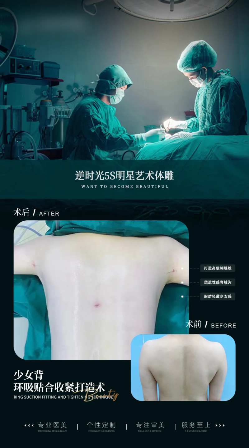 医美背部吸脂案例对比海报-采灵感-cailinggan.com