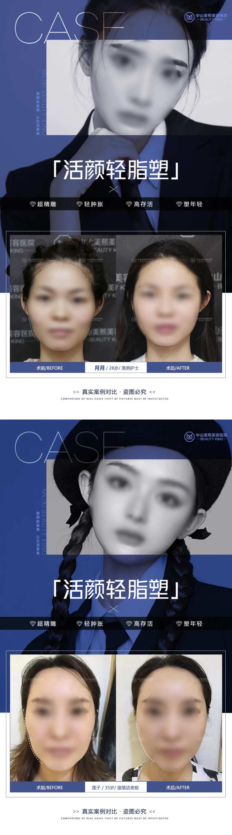 医美脸部填充案例海报-采灵感-cailinggan.com