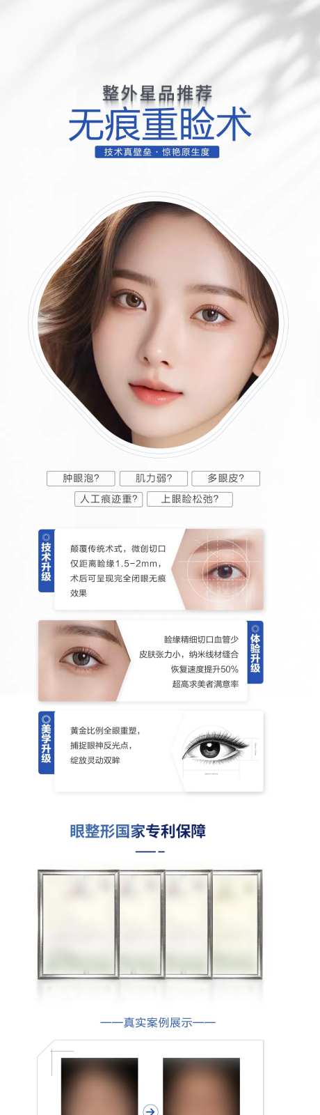 无痕双眼皮术海报-采灵感-https://www.cailinggan.com/