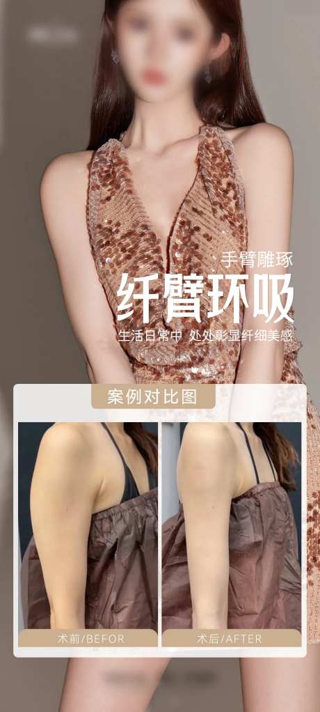 医美纤细手臂案例海报-采灵感-https://www.cailinggan.com/