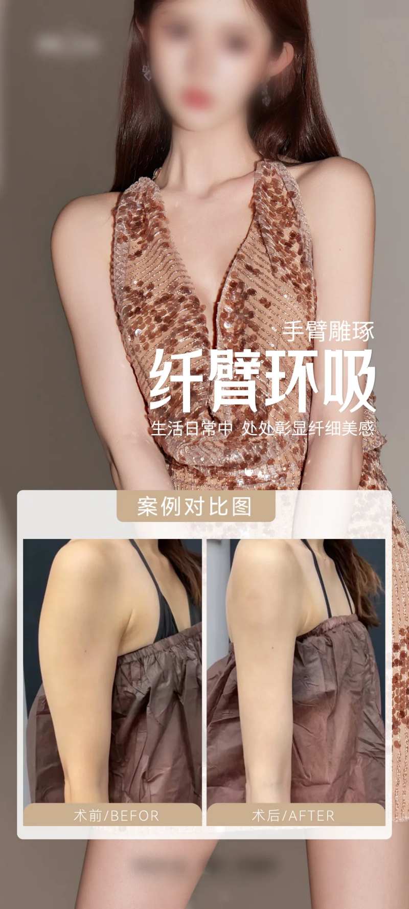 医美纤细手臂案例海报-采灵感-cailinggan.com