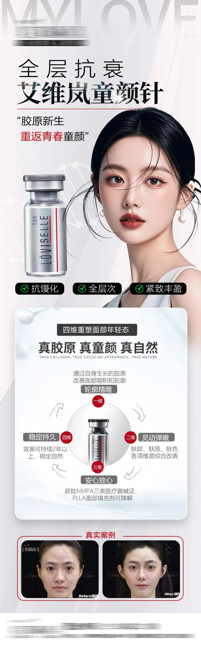 医美艾维岚童颜针海报-采灵感-cailinggan.com