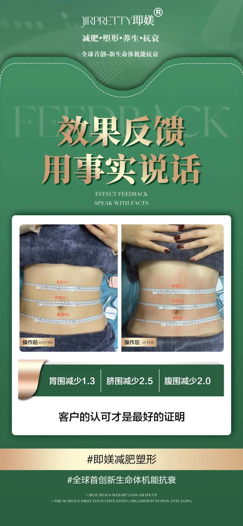 减肥对比案例海报-采灵感-cailinggan.com