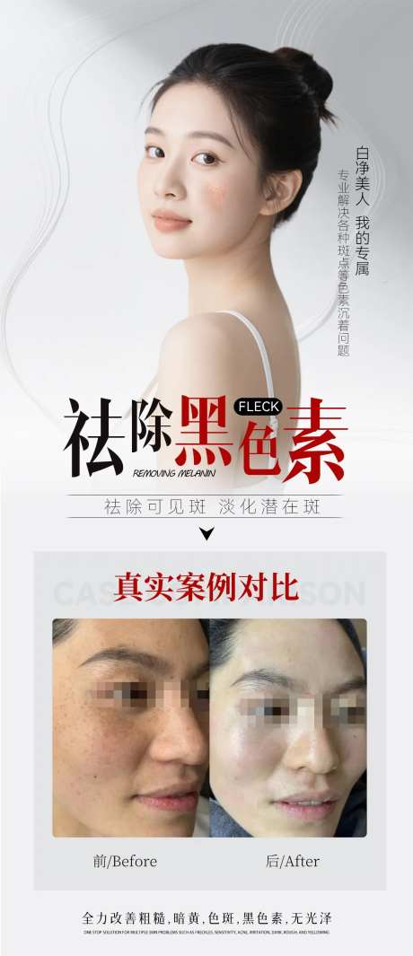 祛斑对比海报-采灵感-https://www.cailinggan.com/