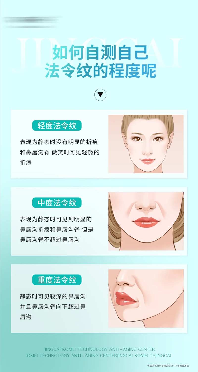 如何自测自己的法令纹程度-采灵感-cailinggan.com